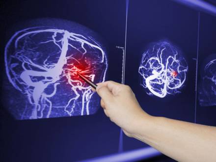 Grundy County, IL Car Accident Attorney